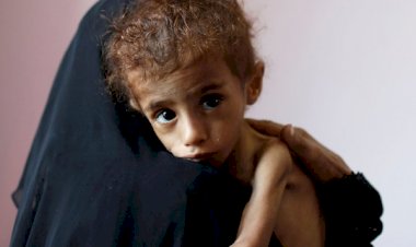 Yemen'de 400 bin çocuk bu yıl açlıktan ölme tehlikesiyle karşı karşıya