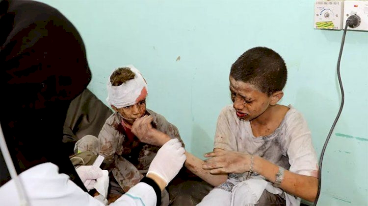'Yemen'deki saldırı bizi dehşete düşürdü'