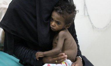 BM: Yemen'de 5 milyon kişi kıtlığın eşiğnide