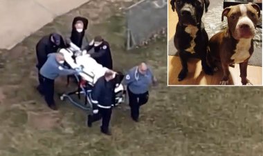 Alman şirketinden araştırma: Yılda 35 bin kişi köpek saldırılarında ölüyor