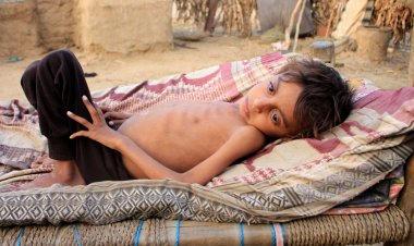 UNICEF: Milyonlarca Yemenli açlığa sürükleniyor