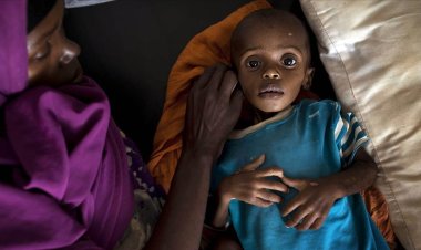 Renkleri ‘farklı’ olsa gündem olurdu ama..! Somali'de iki çocuk ‘açlıktan’ öldü!