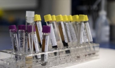 İngiltere'deki gizemli hepatit virüsü Avrupa ve ABD'de yayılmaya başladı