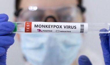 DSÖ'den maymun çiçeği  açıklaması: Toplu aşılamaya gerek yok