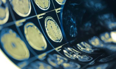 Beynimiz hangi yaşta zirveye ulaşıyor? Bilim insanları açıkladı