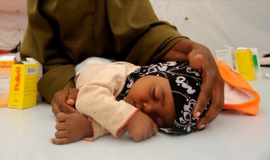 Zimbabve'de 157 çocuk kızamık salgınında hayatını kaybetti