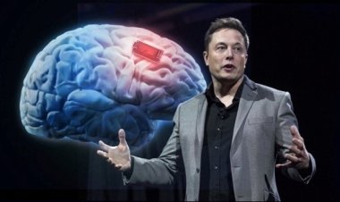 Musk'ın beyin implantı şirketi, insan denemelerine ortak arıyor