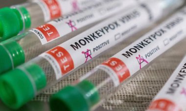 DSÖ: Dünya genelinde 90 binden fazla vaka görüldü