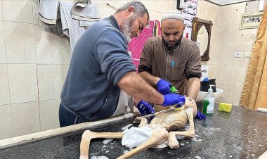 Gazze'de yetersiz beslenme sonucu şehid olan Filistinli çocuktan geriye bir deri bir kemik fotoğrafları kaldı