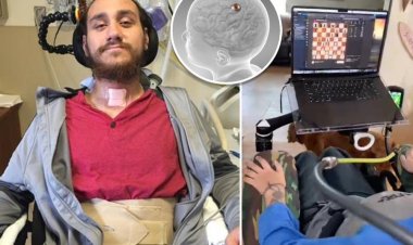 Beyin çipi takılan hasta düşünce gücüyle satranç oynadı