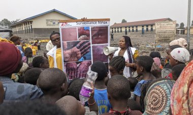 BM, Afrika'da giderek artan M çiçeği virüsünün kıta dışına yayılmasından endişeli