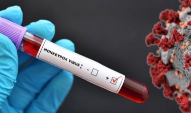 Filipinler'deki aktif mpox vakaları 14'e yükseldi