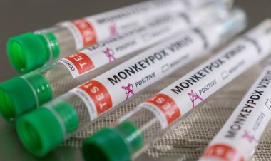 İngiltere'de maymun çiçeğinin yeni varyantı tespit edildi