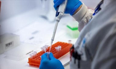 DSÖ: M çiçeği virüsü acil durum oluşturmaya devam ediyor