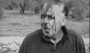 Gaspçı İsrailliler, işgal altındaki Batı Şeria'da 3 çiftçiyi yaraladı