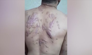 Filistinli Ebu Tavile işkenceyle gözünü kaybetti