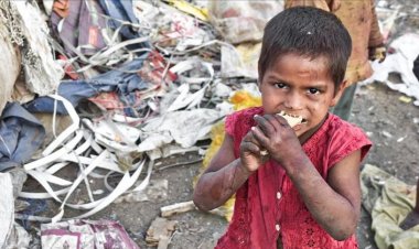 Yemen'de 5 yaş altı her 2 çocuktan 1'i akut yetersiz besleniyor