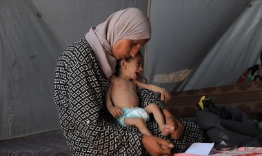 UNICEF: Haziran ayında Gazze’de 5800 çocuğa yetersiz beslenme teşhisi konuldu