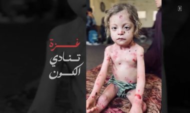 Kim siler o çocuğun yanaklarındaki yaşı?