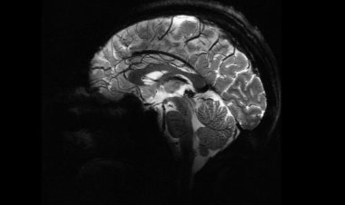 Pandemi beyinleri hızla yaşlandırdı