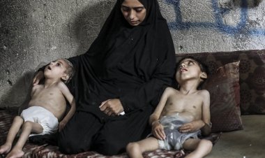 Gazze'den dönen İngiliz doktor: Açlıktan 'kitlesel ölümler' olabilir