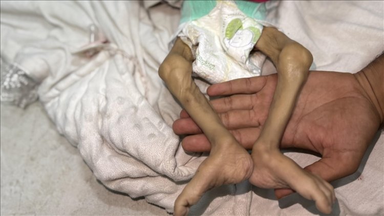 Gazze Şeridi'nde son 24 saatte 1'i çocuk 14 Filistinli açlıktan şehit oldu