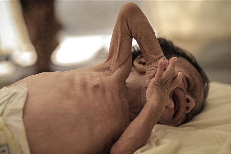Gazze’de akut yetersiz beslenen 5 yaş altı çocuk sayısı 3 kat arttı