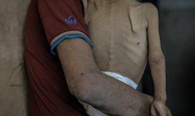 Katil İsrail'in ablukasında Gazze'de 5 kişi daha açlıktan yaşamını yitirdi