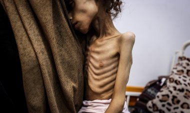 Gazze'deki doktor: Böyle şeyleri kitaplarda okurduk şimdi birebir şahit oluyoruz