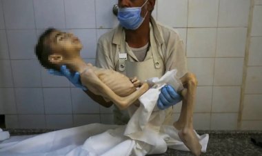 Gazze'de açlık nedeniyle 2 kişi daha can verdi