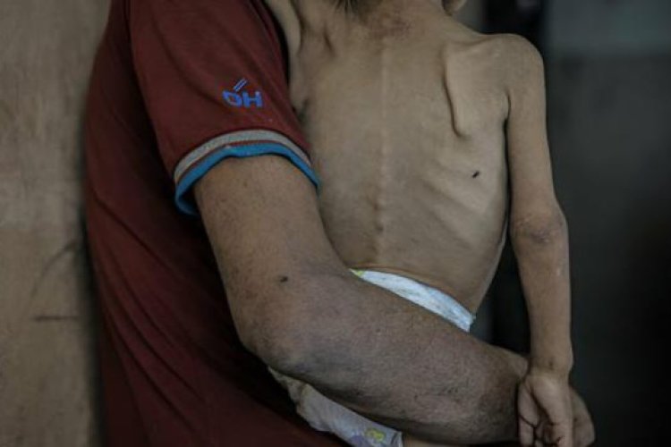 Katil İsrail'in ablukasında Gazze'de 5 kişi daha açlıktan yaşamını yitirdi