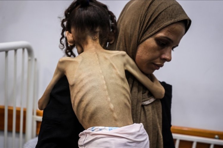 Katil İsrail’in kıtlığa sürüklediği Gazze’de 9 yaşındaki Meryem 10 kiloya düştü