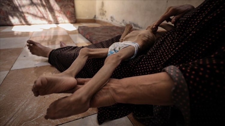 Gazze'de son 24 saatte 2'si çocuk 5 kişi daha açlıktan şehit oldu