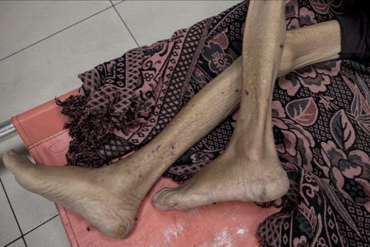 Gazze'de son 24 saatte 3'ü çocuk 10 kişi daha açlıktan şehit oldu