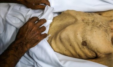 İsrail'in kıtlığı dayattığı Gazze'de son 24 saatte 7 kişi daha açlıktan şehit oldu