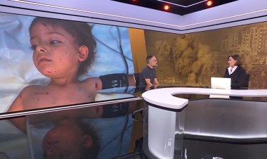 İspanyol doktorun Gazze tanıklığı: “Çocukların acısını sayamaz oldum”