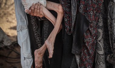 Katil İsrail'in kıtlığı dayattığı Gazze'de 453 kişi açlıktan hayatını kaybetti