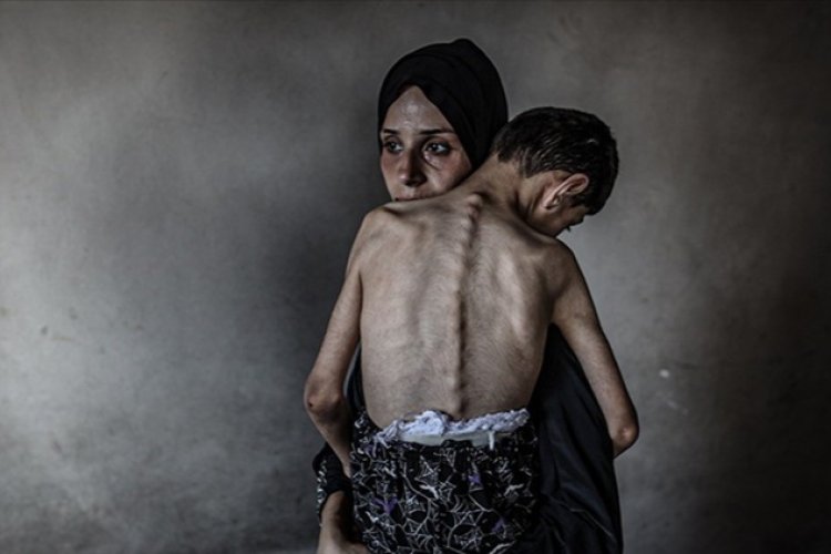 Gazze'de ağustos ayında 185 kişi açlıktan yaşamını yitirdi