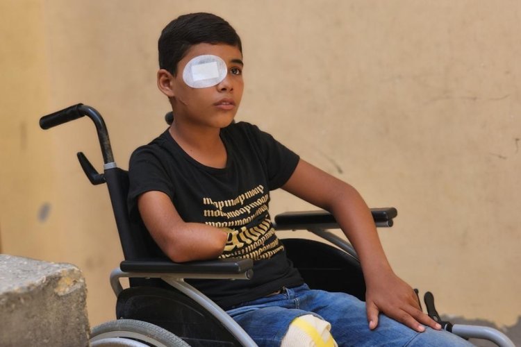 Siyonist İsrail'in saldırıları nedeniyle Gazze'de 21 bin çocuk sakat kaldı
