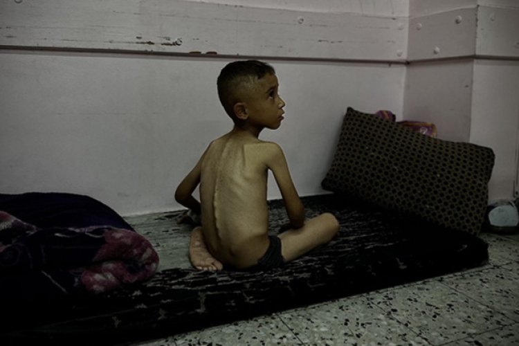 Gazze'de son 24 saatte 1'i çocuk 3 kişi daha açlıktan şehit oldu
