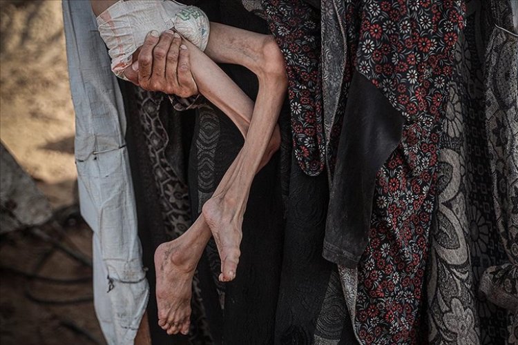 Katil İsrail'in kıtlığı dayattığı Gazze'de 453 kişi açlıktan hayatını kaybetti