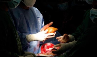 Çığır açan gelişme: Her kan grubuna uyumlu ‘evrensel böbrek’ geliştirildi