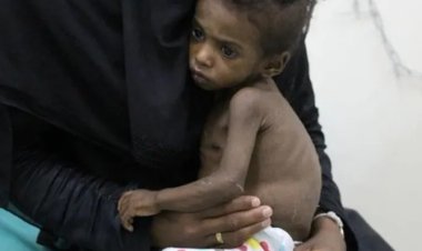 Dünya Bankası: Yemen kıtlığın eşiğinde