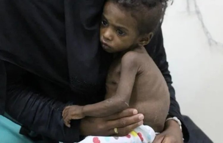 Dünya Bankası: Yemen kıtlığın eşiğinde