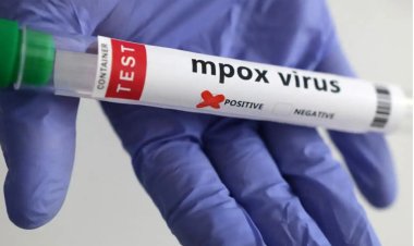 İngiltere’de mpox virüsünün yeni bir türü tespit edildi