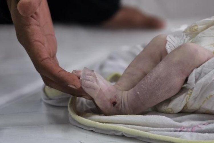 Katil İsrail'in yardım girişini kısıtladığı Gazze'de 2 aylık bebek soğuktan hayatını kaybetti